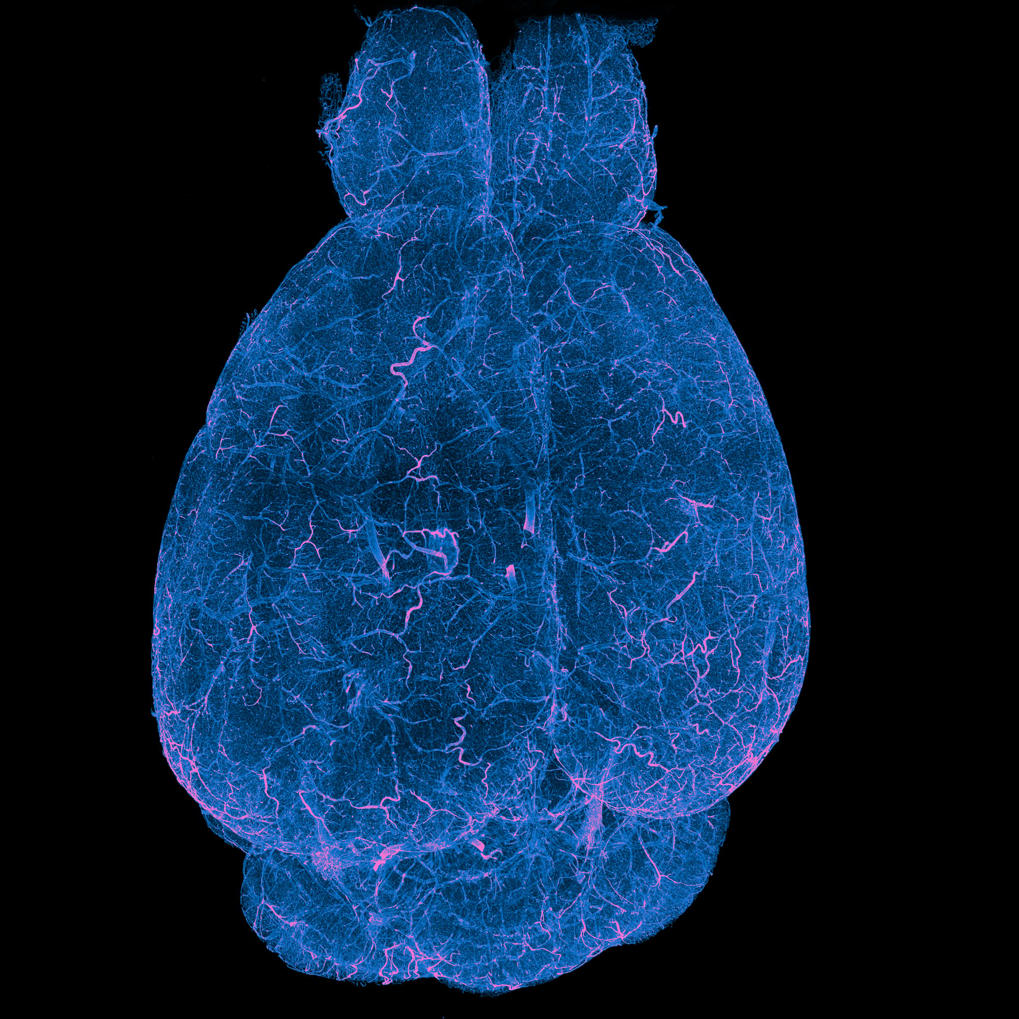 16-18-22_ID002_an000002_g001_mouse_brain_MB1_Blaze_2025-11-21T17-47-47.996