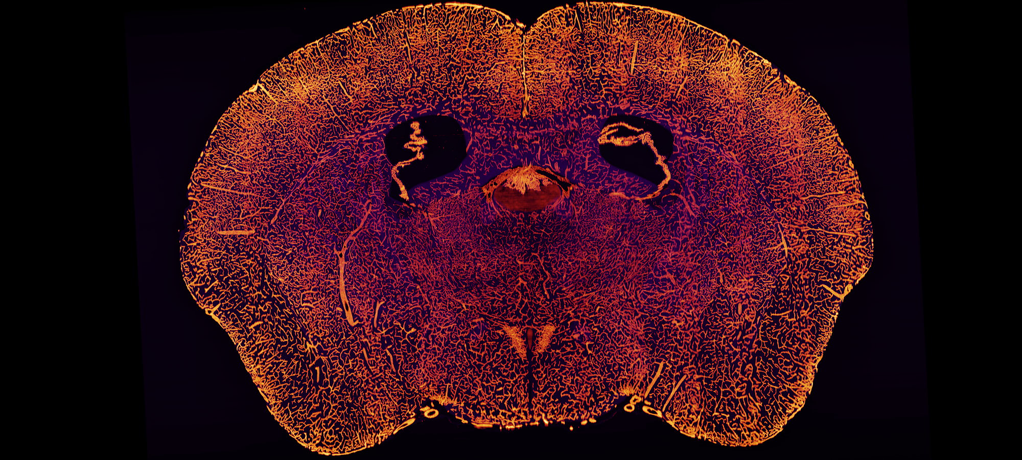 Coronal section of adult mouse brain stained for CD31