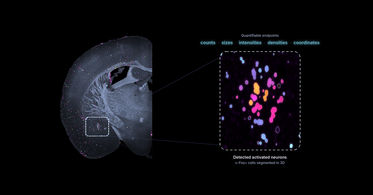 Light sheet image of a coronal mouse brain hemisphere with a highlighted region enlarged to show individually segmented c-Fos+ activated neurons. Labels list the quantifiable endpoints: counts, sizes, intensities, densities and coordinates.