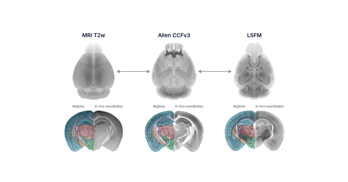 MRI, Allen CCFv3 and light sheet mouse brain atlases linked in one coordinate space, from the Perens multimodal atlas paper (Neuroinformatics, 2023).