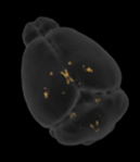 brain_1-1