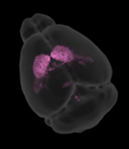 brain_5-1