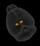 brain_6-1