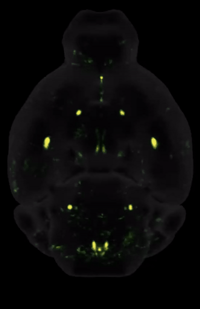 Whole brain c-Fos in response to Ozempic