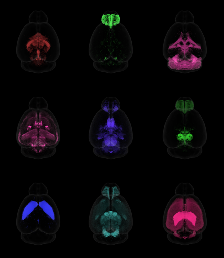 CNS-Voyager composite brain view CNS-Voyager composite brain view